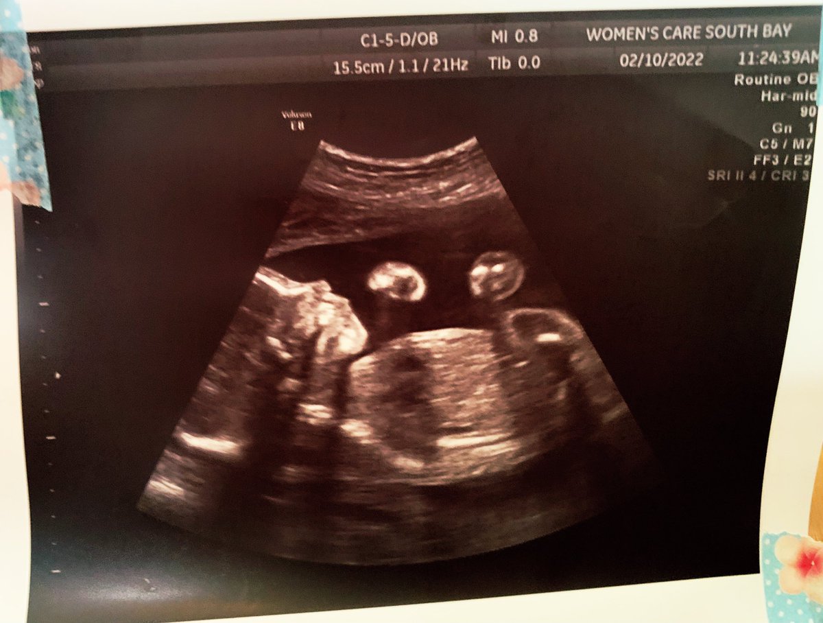 Well, this was unexpected. Fam & friends are shocked, but ...