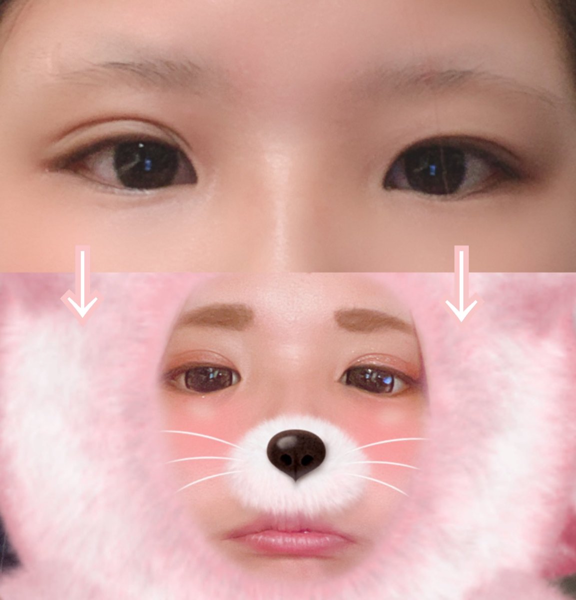 shiboonQ's tweet photo. 整形垢らしく…プロフィール✎*。

2019/11
○埋没

2021/12…DT中
○太もも+臀部+膝  脂肪吸引

2022/2…DT中
○頬+顎下+ジョール  脂肪吸引
○メーラー+バッカルファット除去
○糸リフト3種
○エラ+顎ボトックス
○フェイスタイト(頬+顎+顎下)
○顎=脂肪注入

 #私の整形歴史 https://t.co/C4ZXxYjtMv