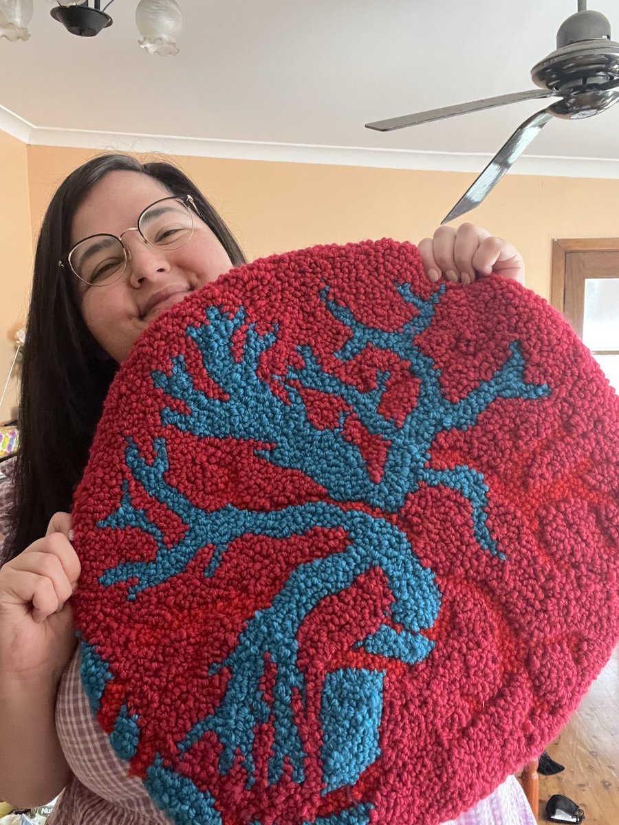 drsarahdelforce (@sarahdelforce) on Twitter photo So grateful for <a href="/EmmaOolemma/">Dr Emmalee Ford</a> and <a href="/AlexEPeters/">Alexandra Peters</a> for this incredibly thoughtful and super ruddy (ruggy) cool present ❤️👩🏻🔬 #placentasmatter So grateful for <a href="/EmmaOolemma/">Dr Emmalee Ford</a> and <a href="/AlexEPeters/">Alexandra Peters</a> for this incredibly thoughtful and super ruddy (ruggy) cool present ❤️👩🏻🔬 #placentasmatter