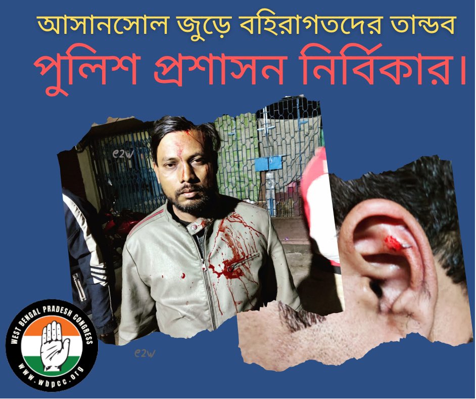 INCWestBengal's tweet image. #BengalMunicipalElections2022
আসানসোল জুড়ে বহিরাগতদের তান্ডব!! পুলিশ প্রশাসন নির্বিকার।  

বিভিন্ন লজে তল্লাশির সময় বহিরাগতদের হাতে আক্রান্ত কংগ্রেস কর্মী ।

#TMCterror #টিএমসি_সন্ত্রাস
