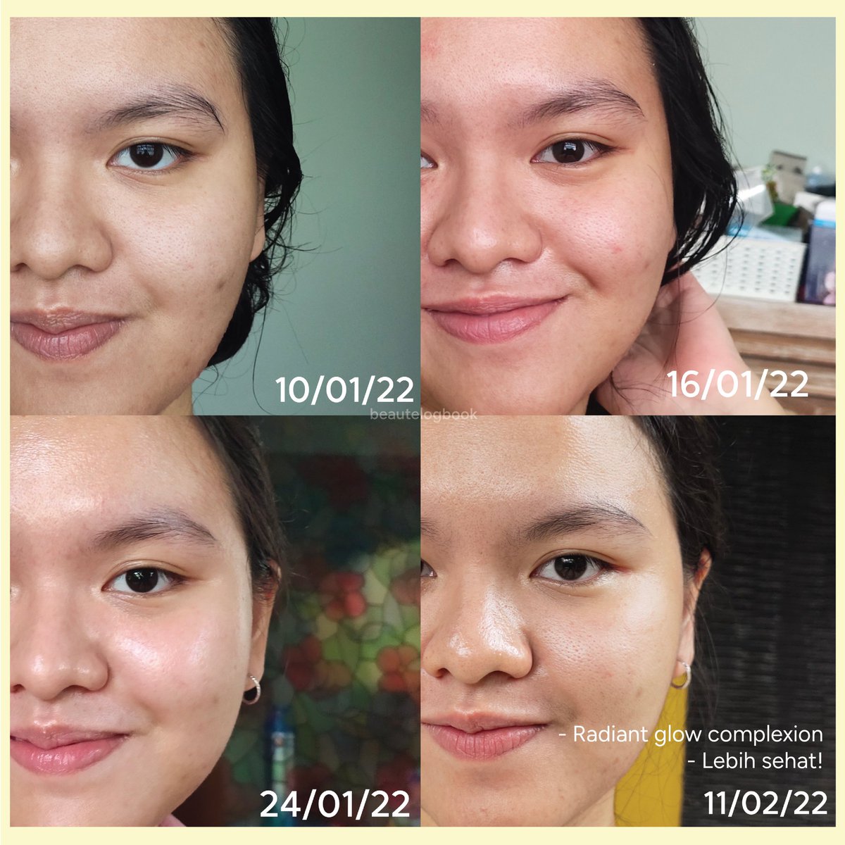 beautelogbook's tweet photo. Dua serum yang berbeda tapi saling melengkapi dan bikin kulit sehat, plump, dan โจglowenkโจ dalam sebulan:
Overnight Skinpair dan Noni Glow Concentrate dari @Adara_ID!
Aku mau share final reviewku buat keduanya. Yuk disimak!โจ
โ #StepUpnGlow #racuninskincare https://t.co/s4qLjoRuRA