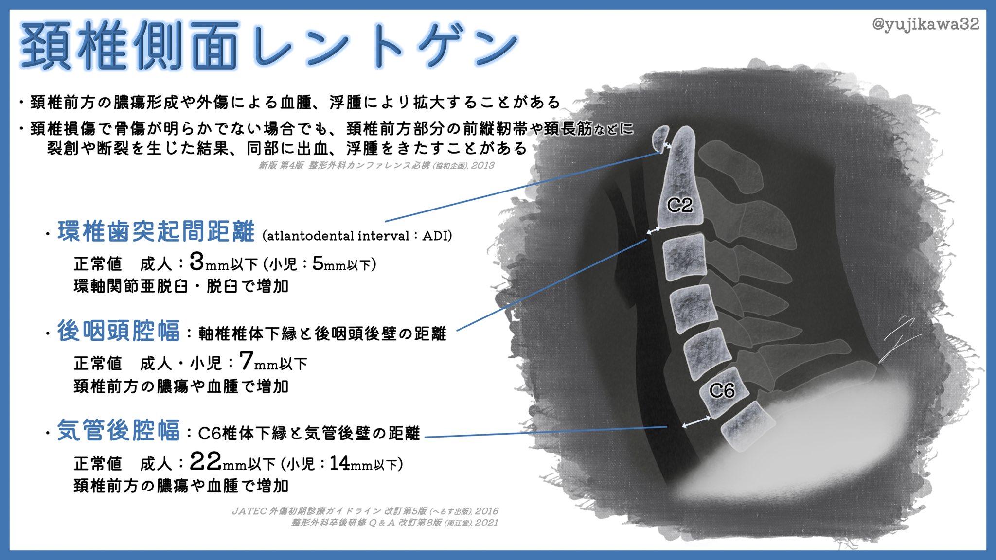 ユジカワ 整形dr イラストレーター 頚椎側面レントゲン検査で特に見るべきところについて レントゲン検査では 意外と骨以外の情報も多い 頚椎 レントゲン イラスト日記 T Co 0gzyz4zc Twitter ユジカワ 整形dr イラストレーター 頚椎側面レントゲン検査で特に見るべきところについて レントゲン検査では 意外と骨以外の情報も多い 頚椎 レントゲン イラスト日記 T Co 0gzyz4zc Twitter