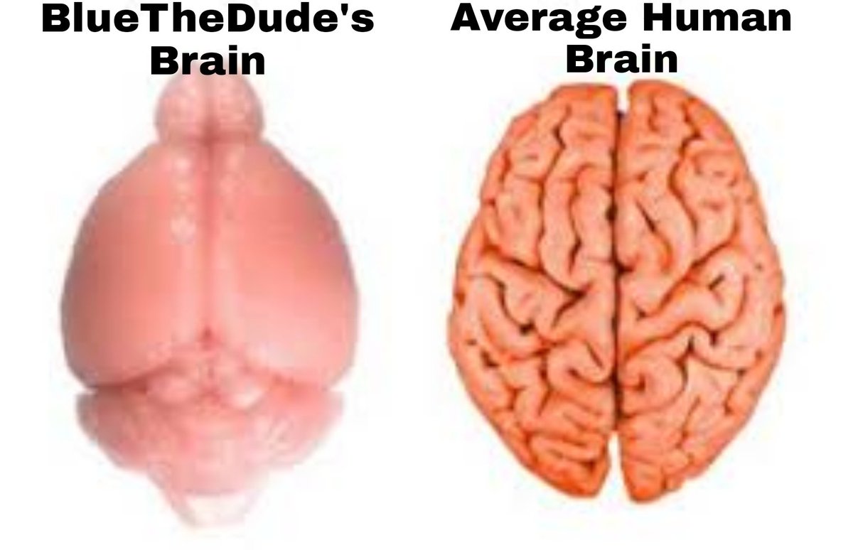 JustKiddinRight's tweet photo. @bluethedudelive #SmoothBrainAwareness https://t.co/FQVNX0NYt0