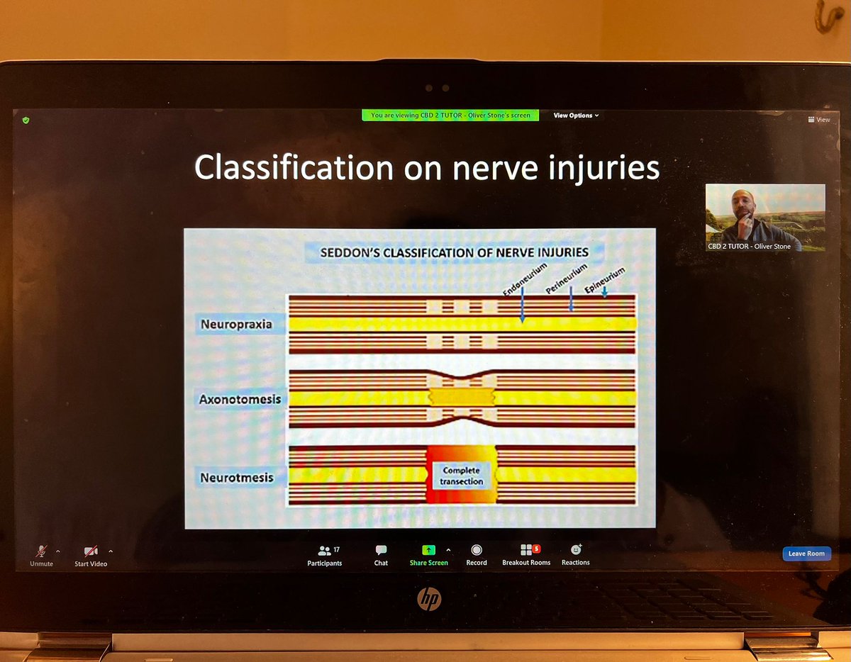 sworthoconf's tweet image. SWOC 22 breakout sessions highlighting: 
- Ways to building your surgical CV
- Importance of shared decision making
- Hand and wrist surgical complications 

 #OrthoTwitter
 #MedTwitter
 #SWOC22