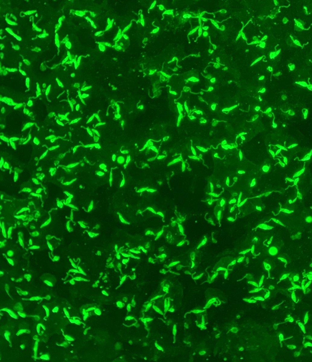 JDuraesO's tweet photo. First post got to go to this photo I took last week of Leishmania sp. promastigotes! 
#parasitology #leishmania #miscroscopy 
@TrendsParasitol https://t.co/QFdyf43yIK
