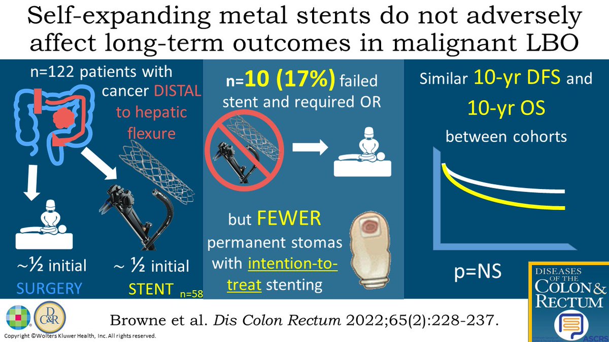DCRjournal's tweet photo. What do you think of this #DCRJournal visual abstract: Self Expanding Metal Stents in Acute Large Bowel Obstruction: A retrospective analysis: https://t.co/wV3Flca1Vh

@JISBMD @KyleCologne @dubaicolorectal @SamAtallahMD @debby_keller @SeanLangenfeld @TonyMacLean3 @audreykulaylat https://t.co/v68kGCuSNn
