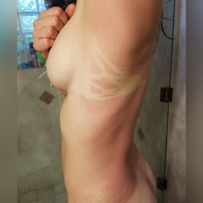 Caught a burn.  Ouchie. https://t.co/B6RTjRZoay