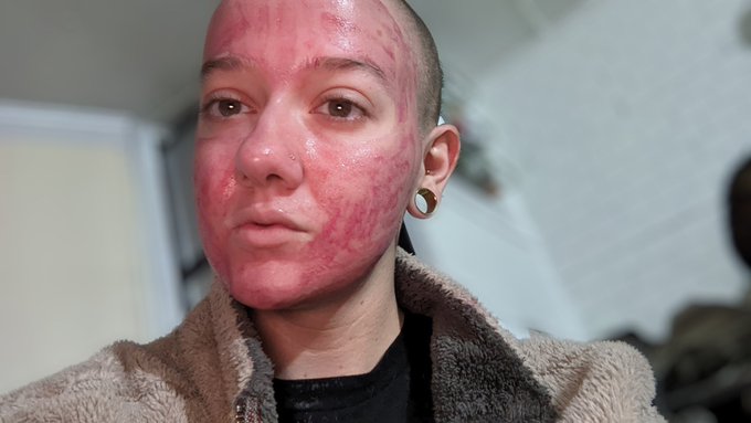 Blood of my enemies 💅🏻✨  Nonbinary findom https://t.co/04UZdXyCmQ<a href="/tag/newprofilepic"class="tags"><span>#newprofilepic</span></a>