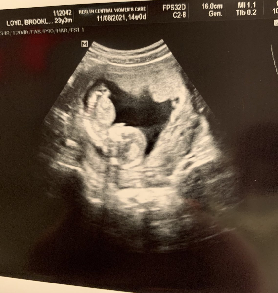 BrooklynnMuse's tweet photo. Case Ryan Muse💙                                  

we can’t wait to meet you💙💙 https://t.co/3FanpX9n7U