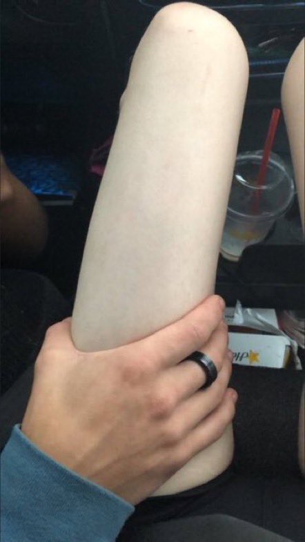 angelsspine's tweet image. This. This is why I wanna be skinny. 

🏷 ed thinspo bonespo edtwt fasting edtwt proana meanspo sweetspo