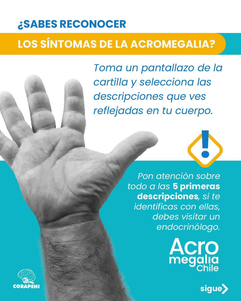 corapehi's tweet photo. Los invitamos a estar atentos a estos síntomas. Por favor ayúdenos a difundir con  un RT #acromegalia #acromegaly #hipofisis #pituitary #tumordehipofisis #pituitarytumor https://t.co/lTWbiNqDlj