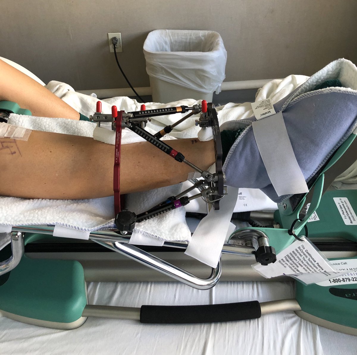 Who says you can’t use a CPM with a frame on?