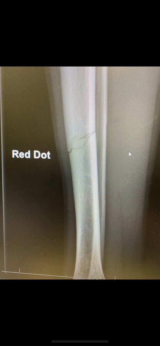 Jake Ebbers Ebling tweet media