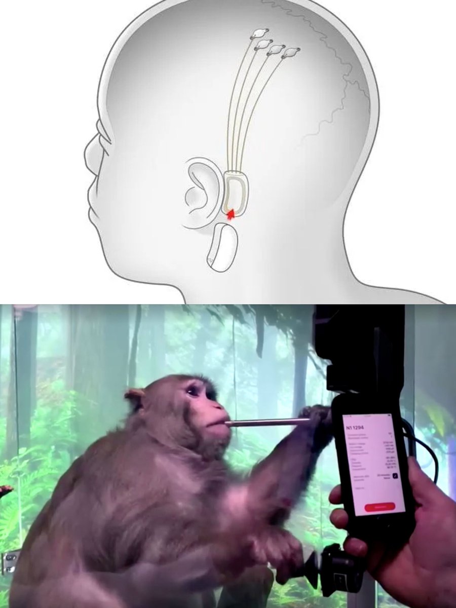 PopBase's tweet photo. At least 15 out of 23 monkeys implanted with Elon Musk’s Neuralink brain chips have reportedly died.

Elon previously announced that Neuralink was preparing to launch human trials for the brain chips this year. https://t.co/qyKA7SE1Sv