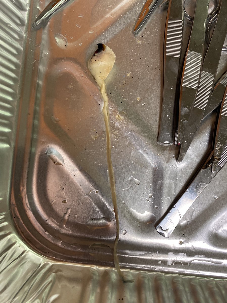 Check out the size of beak and esophagus!!