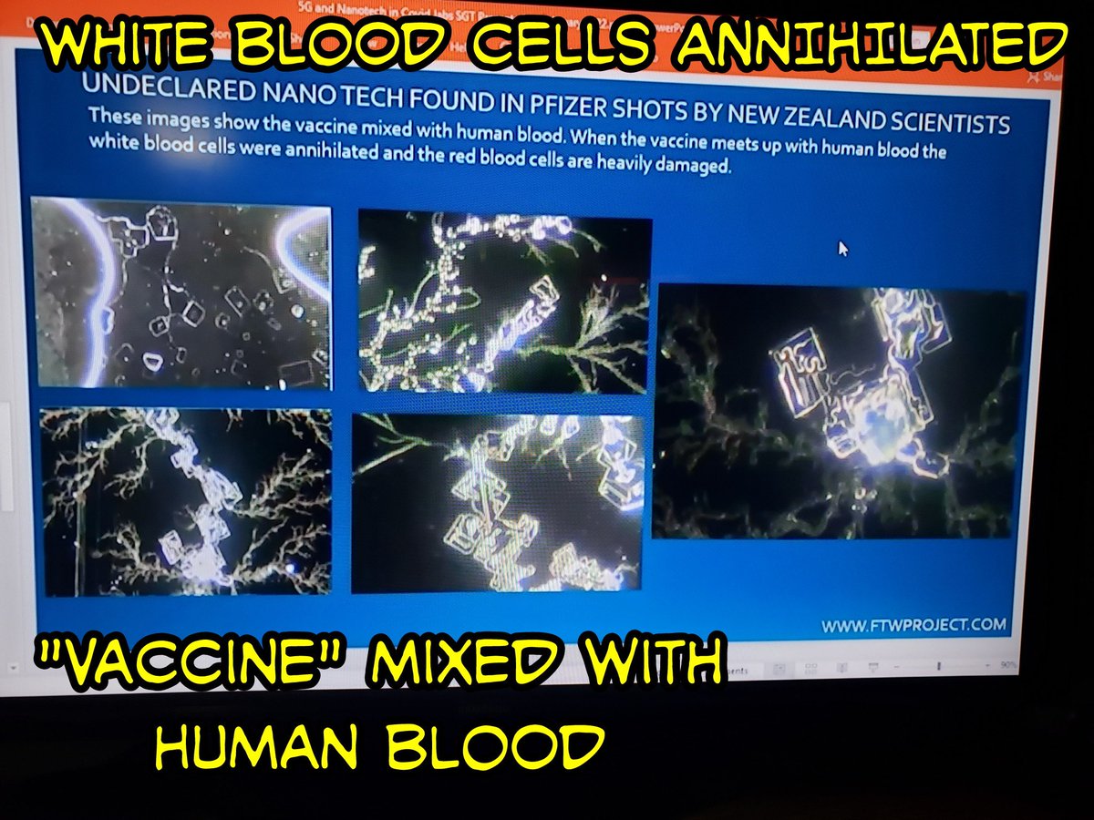 3PsOfEvil's tweet photo. @codavison @cryptozeus1 @JustinTrudeau If you want truth about what's in the vaccines, here you go. LOTS WILL BE DEAD IN FIVE YEARS. EDUCATE YOURSELF WOMAN. SERIOUSLY. 
https://t.co/OrqRiYEBoa
2nd part
https://t.co/olXJMstSaZ https://t.co/FNm3UdYula