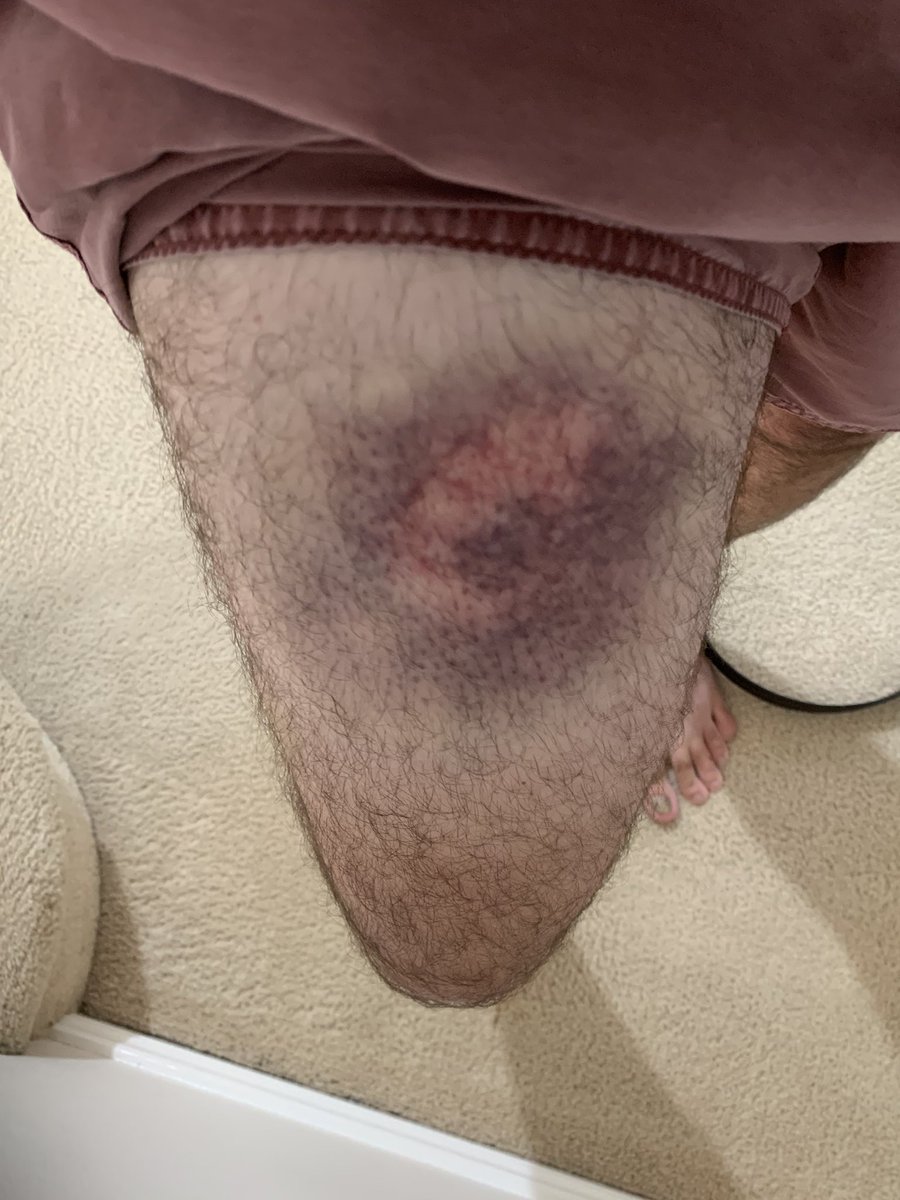 Jon Tuxworth tweet media