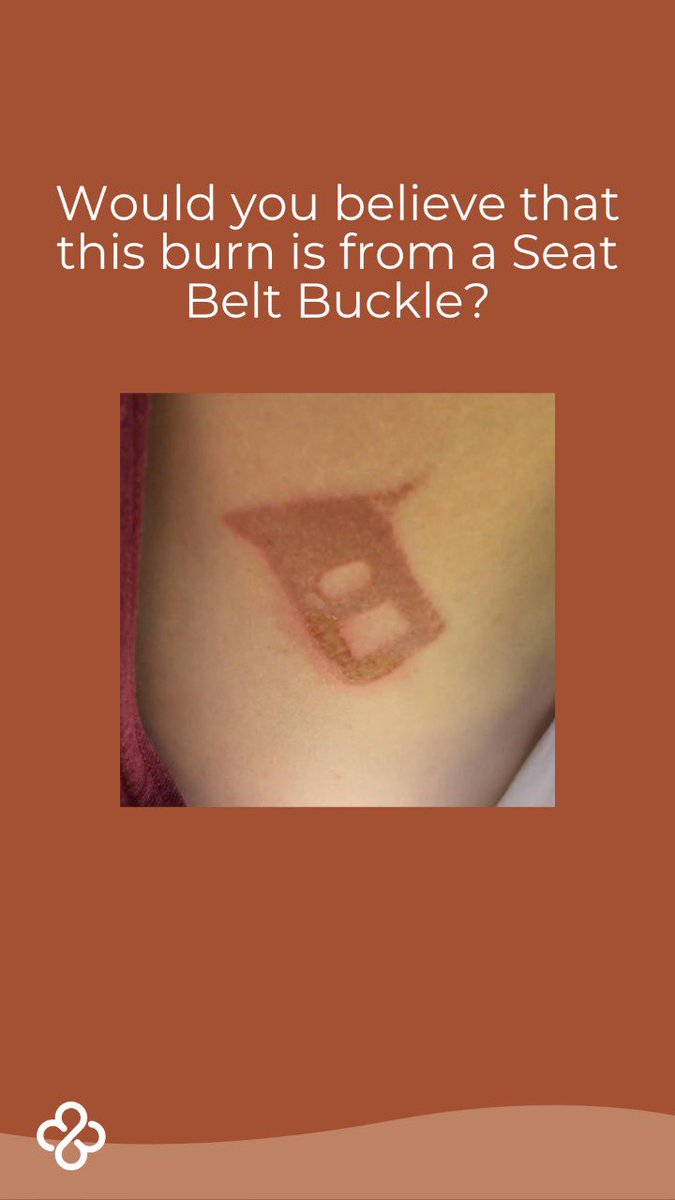 We have launched the first global child safety product to help reduce burns from car seat buckles in Australia! 
Follow our 5 year journey @BuckleBandage
#kids #9News #kidspot #entrepreneur #femaleentrepreneur #australianmade #media #7NEWS