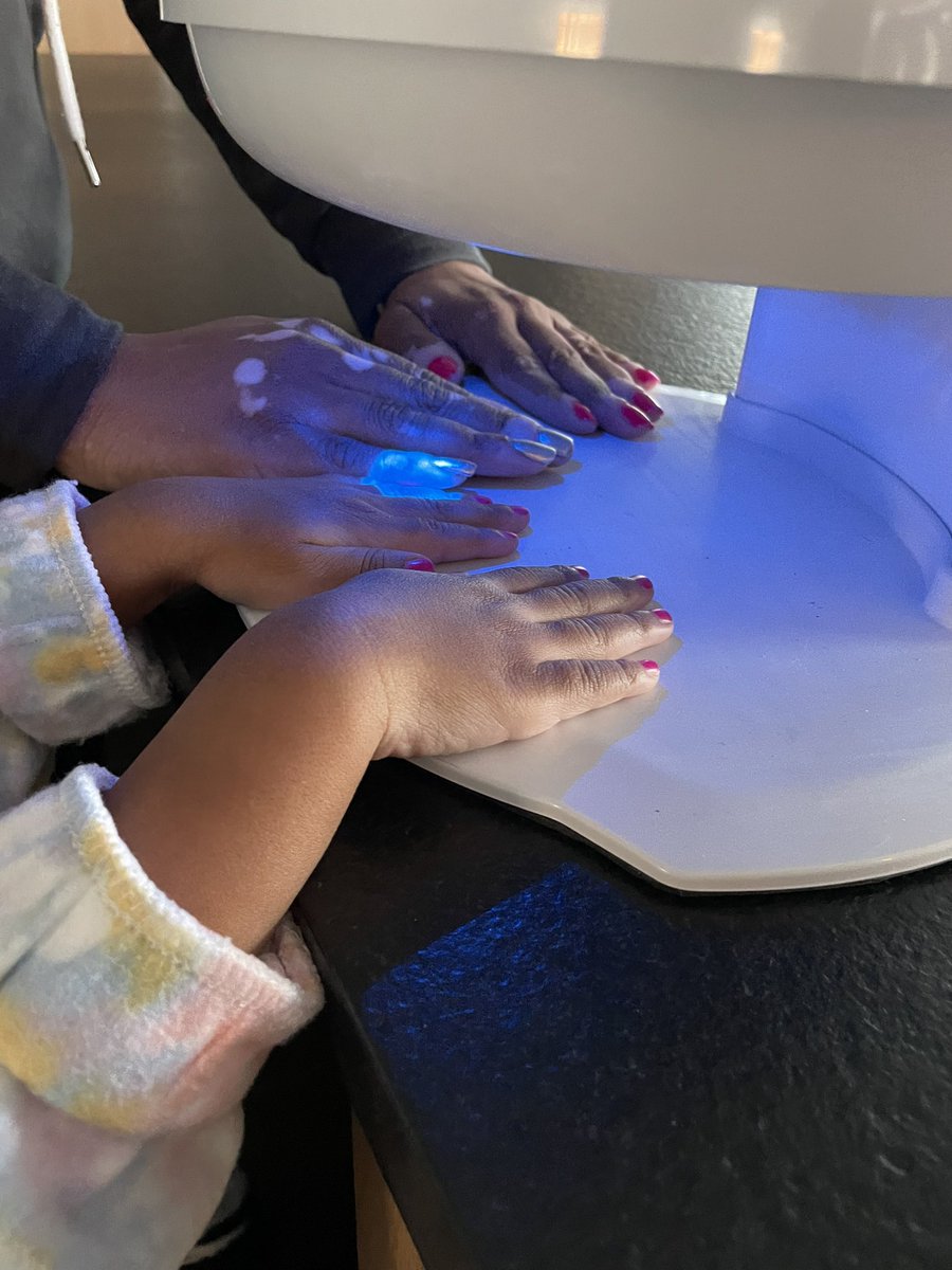 DevonMoodyGrahm's tweet image. Had a #handmodeling gig today with @DEMIbluenn and my mini wanted to join in the fun. They really do watch everything we do. #momlife #ceomomempire #vitiligo #vitiligobeauty