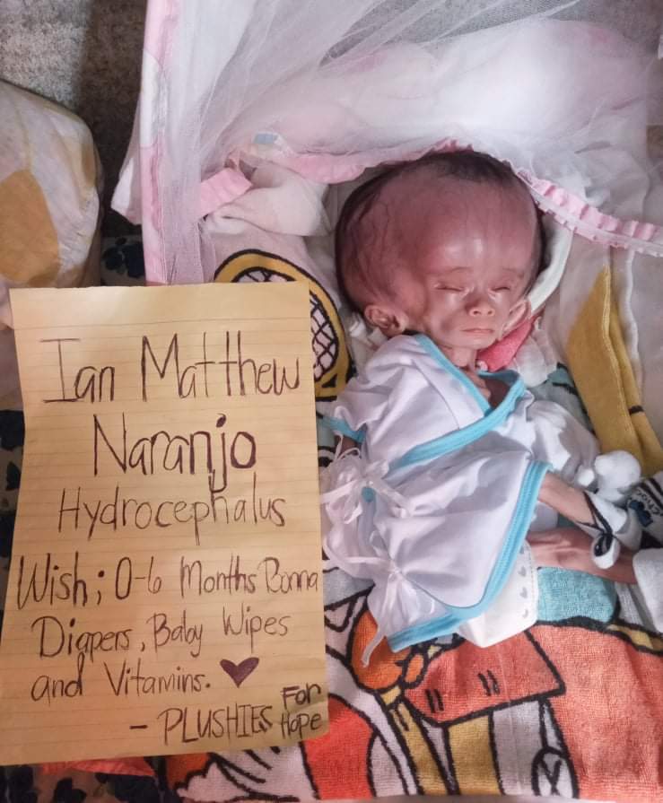 PlushiesForHope's tweet image. Please don't skip without sharing 

Help us raise funds for Baby Ian's needs and operation. Estimated cost for his surgery is 100,000 ($2000). Warrior Ian is 1 month old &amp;amp; was diagnosed with hydrocephalus. Funds will be used for his needs &amp;amp; laboratories.
Donation links on reply+