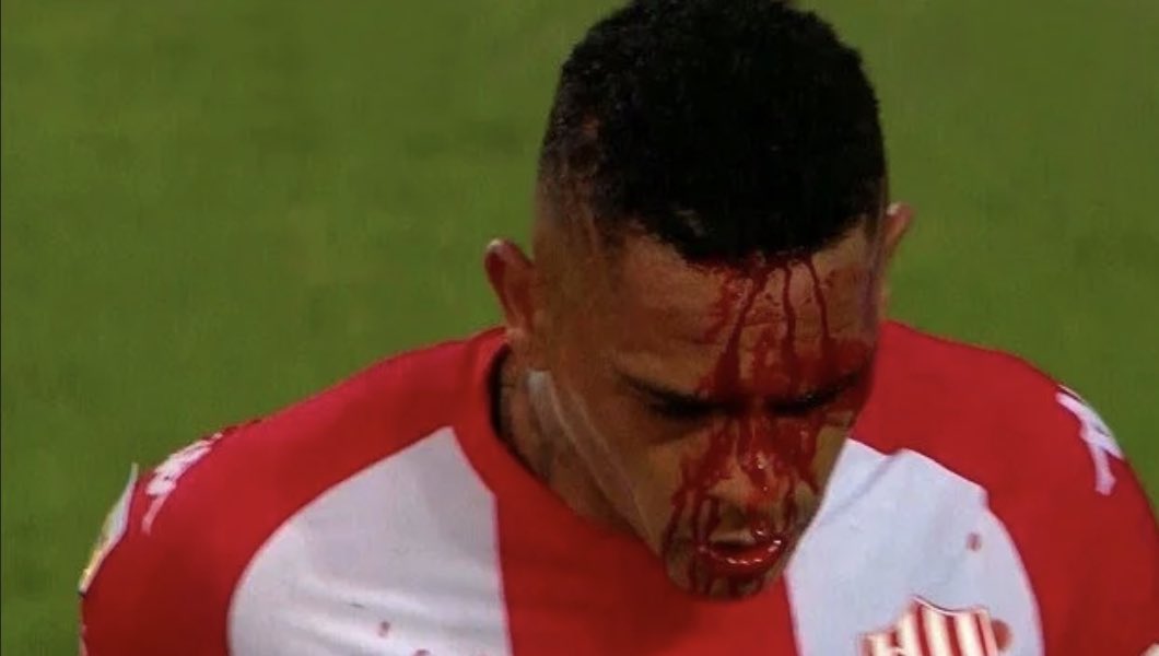 ArgentoElbo's tweet photo. Instalan que a River lo perjudicaron y la realidad es que se tapó algo gravísimo. Paulo Díaz le dio un codazo criminal al uruguayo Alvez, que era penal y expulsión. La TV de FOX (ESPN), se encargó de no repetirla y para el periodismo no existió… 
Así, en yunta, manipulan todo https://t.co/lq2FOQ7mex