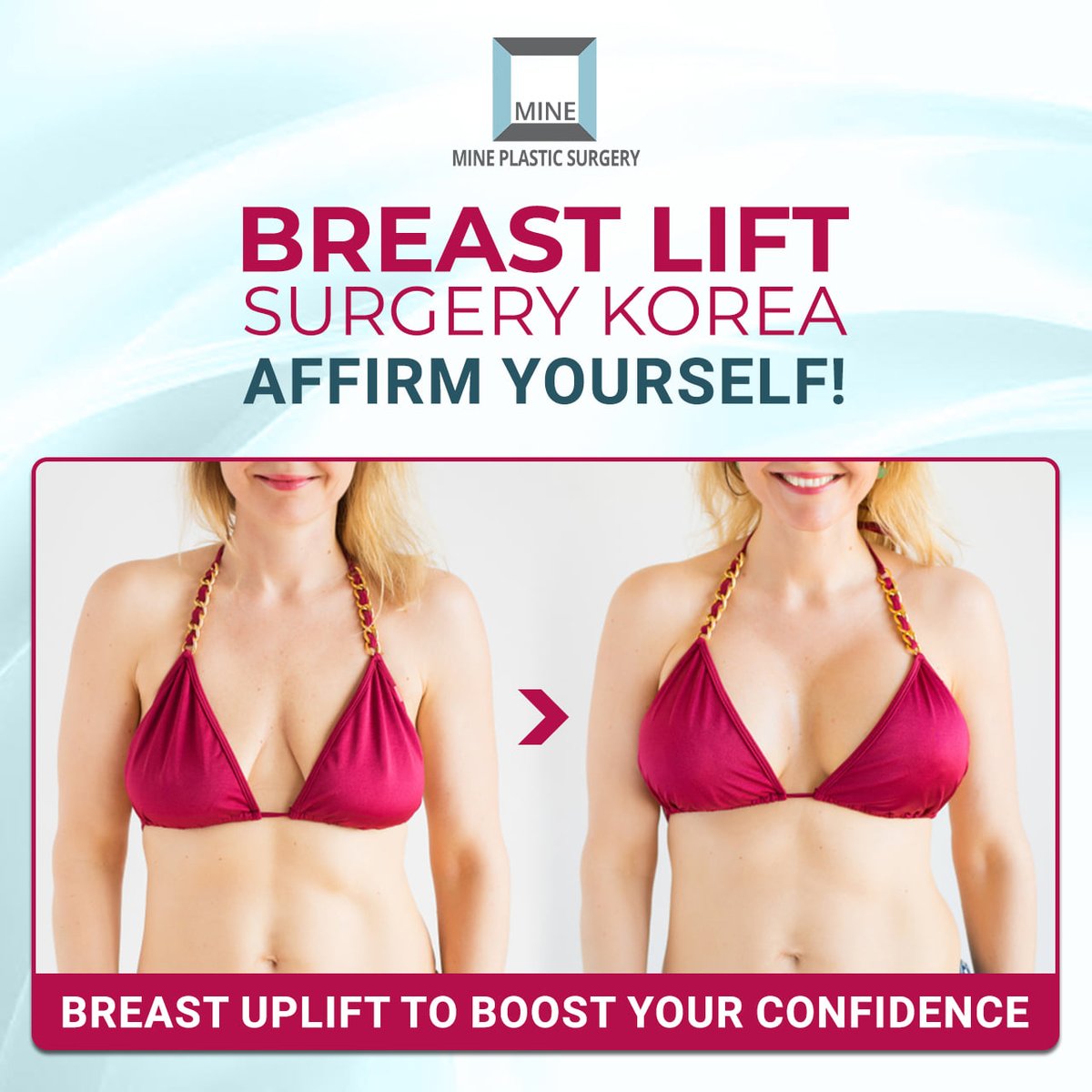 Breast lift surgery improves the quality of life in women.This popular surgical procedure removes excess skin and tightens the surrounding tissue to create a more youthful breast contour.
#breastsurgery #mineclinic #bodyfitness #mineplasticsurgery #koreanbeauty #breastlift