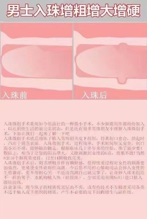 dingjiruzhu's tweet photo. 专业顶级入珠
男性福利
《专业入龙珠》让你变成真正的爷们[嘿哈]
男性入珠人体改造   让她飞  简单的说就是 ~鸟枪变大炮  ，就是把你的小酸黄瓜~变成了大玉米棒子🌽
把你的，短，小，软 ，变的更粗，更大，更硬猛……���时，增大 https://t.co/dde2E0E3o5