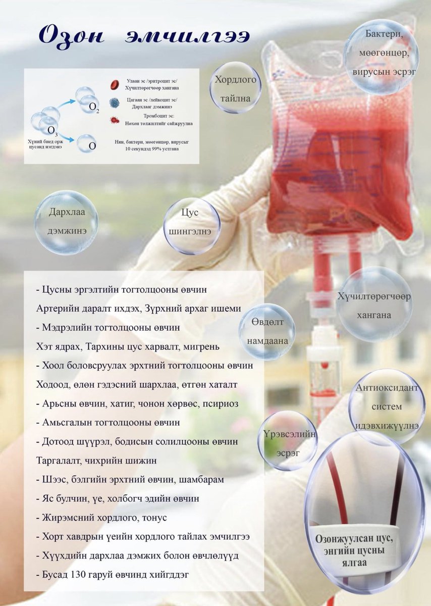 4 тун вакцины буянаар цус өтгөрчихсөн. Озонтой дусал гэдэг юмыг 3 хийлгээд сайхан шингэрчихлээ.
Ковид тусаад эдгэсэн хүмүүс пиг байна. Ганц хийлгээд л нойр нь засарч, цус нь шингэрч байна гэнэ.