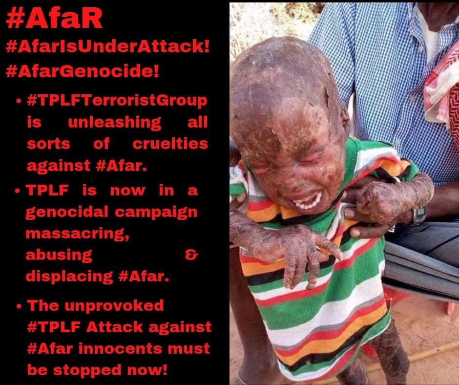Abu_ruffa99's tweet photo. # Not only the #TPLF_ invader_ locust, but the government led by #Dr_Abiy has waged war on #Afar because it is enough to cover up the truth by lying to journalists around the world by pretending that there is no war.
#AfarUnderAttack https://t.co/vsd2dbt3ti