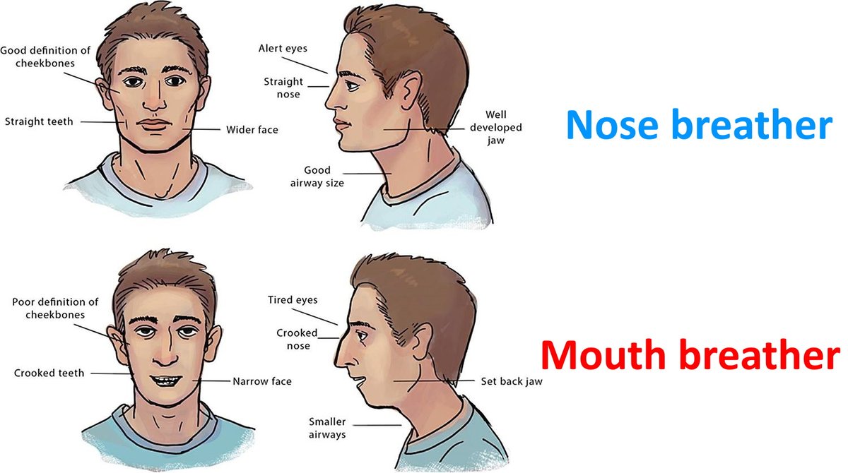 But then also- on top of giving our bodies the nutrients necessary to build healthy structure, we need to apply the pressure to do so. That pressure coming from the tongue up to widen the maxilla, and created a bigger jaw. this concept, "mewing" was pioneered by Mike Mew
