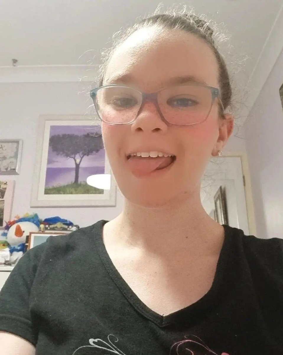JazzHart_'s tweet photo. I'm just gonna leave this here for @BenjiKrol 
#frecklesfilter https://t.co/LkZv8nUgGV