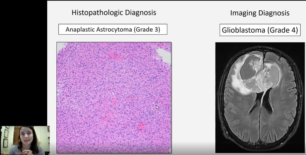 Adventures in Neuropathology tweet media