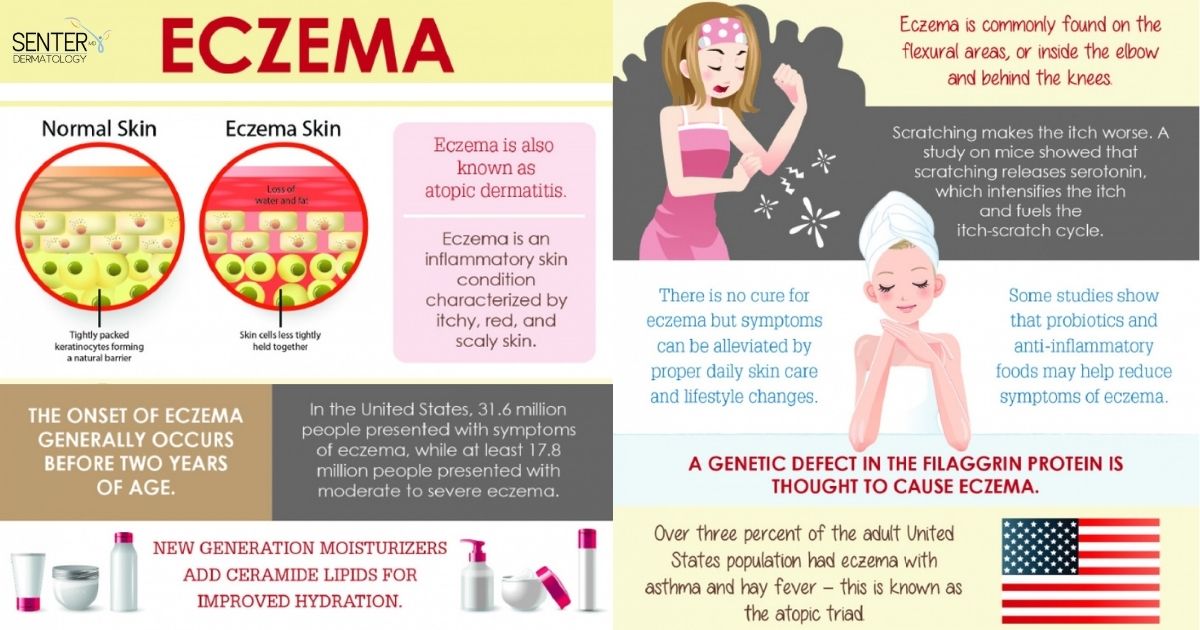 Dr. Senter tweet media