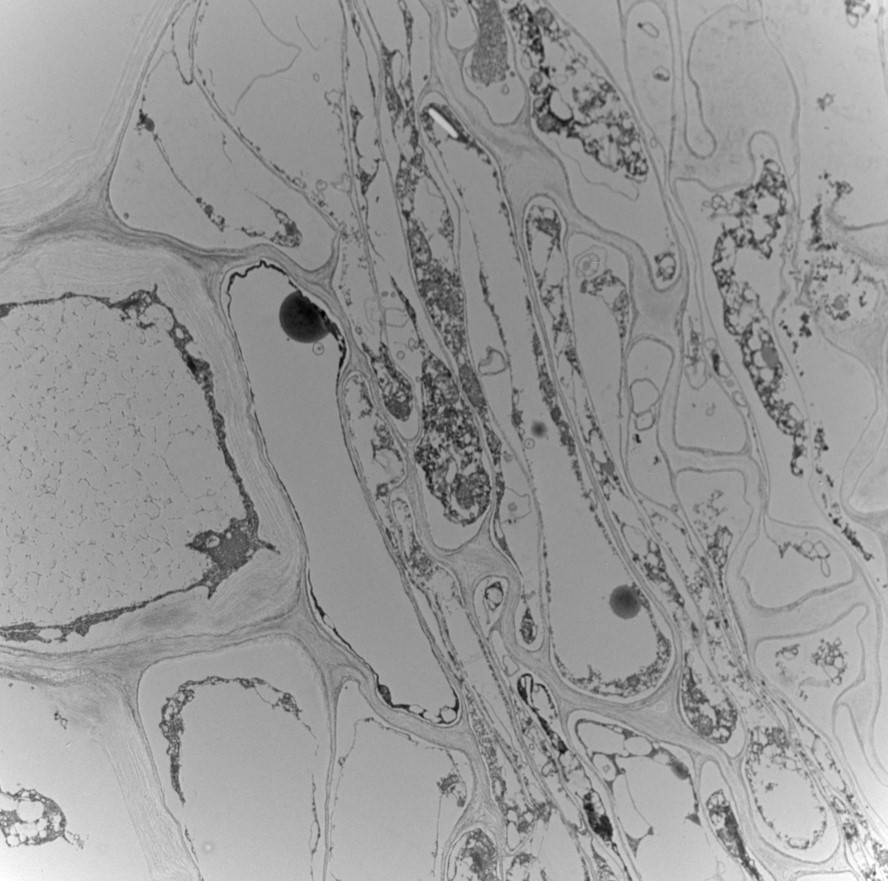 José M. Torres-Ruiz (@torresruizjm) on Twitter photo ☀️Spain&Portugal are suffering the most severe #drought in decades, with catastrophic effects on forest and agricultural systems.
⚠️It is crucial to study the drought's effect on #plant tissues.
👇Transm. Electron Mic. (TEM) images taken with <a href="/MarylouMantova/">Dr. Marylou Mantova</a> for that purpose🔬 ☀️Spain&Portugal are suffering the most severe #drought in decades, with catastrophic effects on forest and agricultural systems.
⚠️It is crucial to study the drought's effect on #plant tissues.
👇Transm. Electron Mic. (TEM) images taken with <a href="/MarylouMantova/">Dr. Marylou Mantova</a> for that purpose🔬