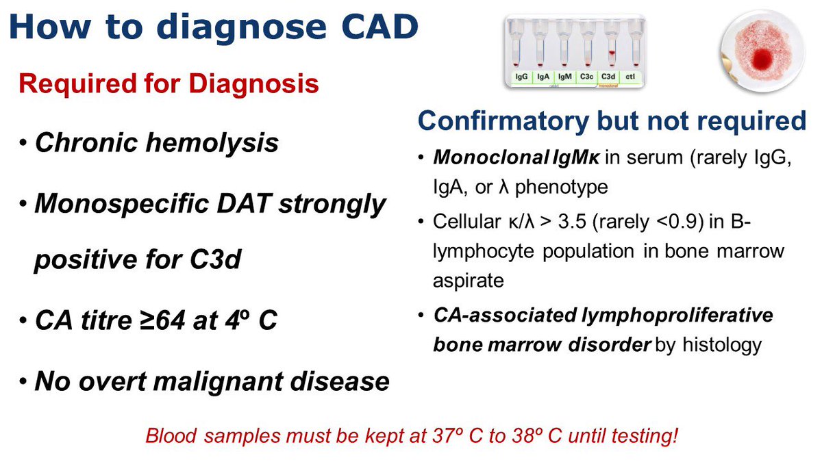 ColdAgglutininDisease (#CAD) can readily be diagnosed based on chronic  hemolysis, positive monospecific DAT/Coombs test for C3d, CA titre >= 1:64  with no overt malignant disease. #anemia #hemolyticanemia #rarediseases  #sutimlimab