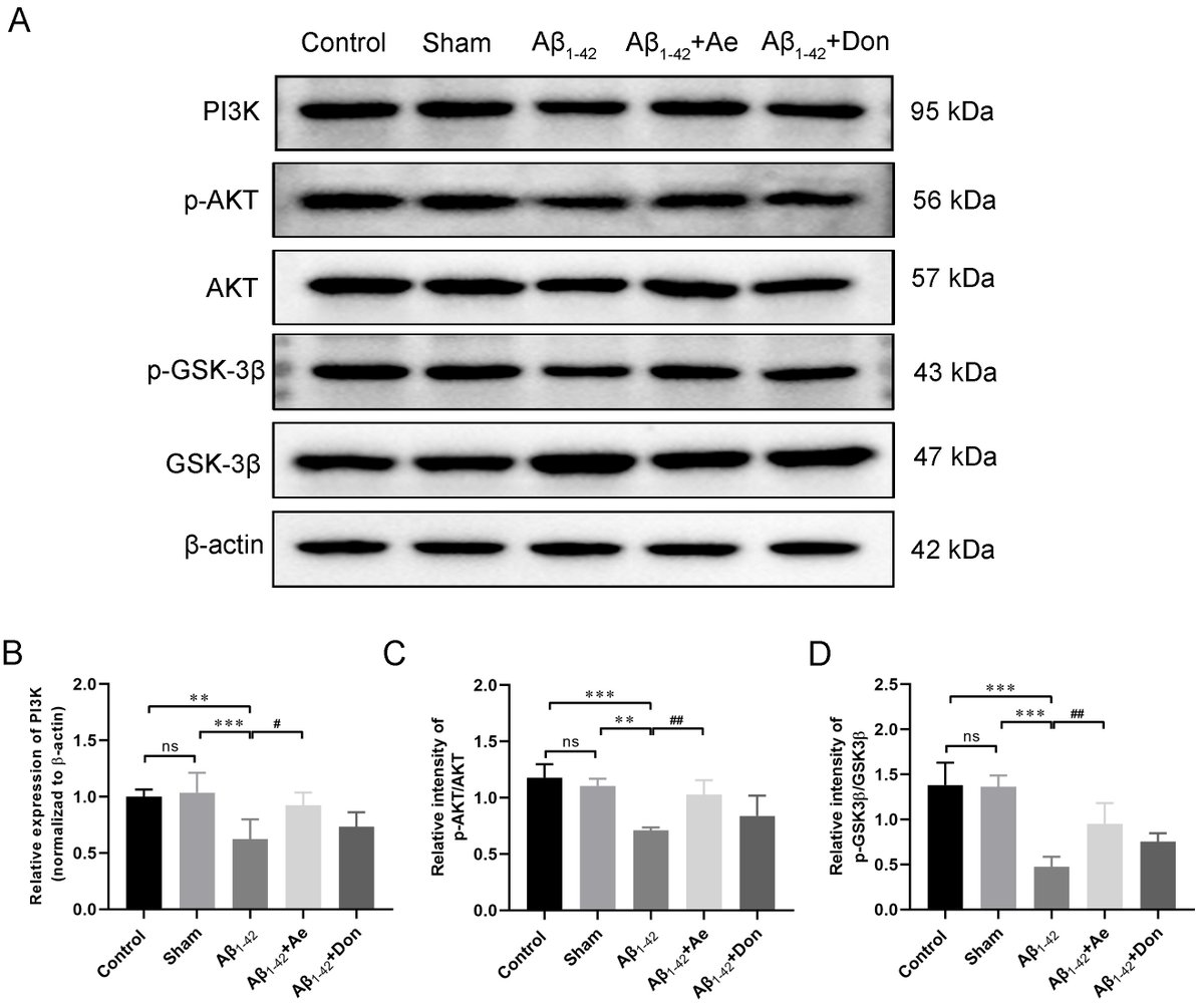 SzeAmber's tweet photo. "olfactory three-needle" could rescue the cognitive deficits of Aβ1−42-induced AD rats by improving synaptic plasticity, neuro-apoptosis and neuro-inflammation through enhancing PI3K/AKT/GSK-3β signaling pathway.
https://t.co/dG5rwkpHyM
#Alzheimers #neuroscience https://t.co/aYuyVIwikk