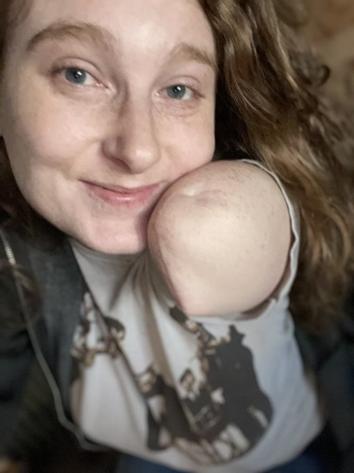 Hey you. Come see what i can do with this nub on my onlyfans! Only $8 till then end of February!!!! https://t<a href="/tag/maxim"class="tags"><span>#maxim</span></a><a href="/tag/amputee"class="tags"><span>#amputee</span></a><a href="/tag/retweet"class="tags"><span>#retweet</span></a><a href="/tag/vote4me"class="tags"><span>#vote4me</span></a><a href="/tag/maximcovergirl"class="tags"><span>#maximcovergirl</span></a>