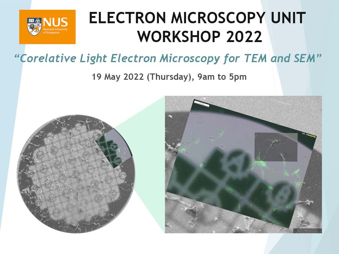 Electron Microscopy Unit Singapore (@emu_nus) on Twitter photo Coming soon! Coming soon!