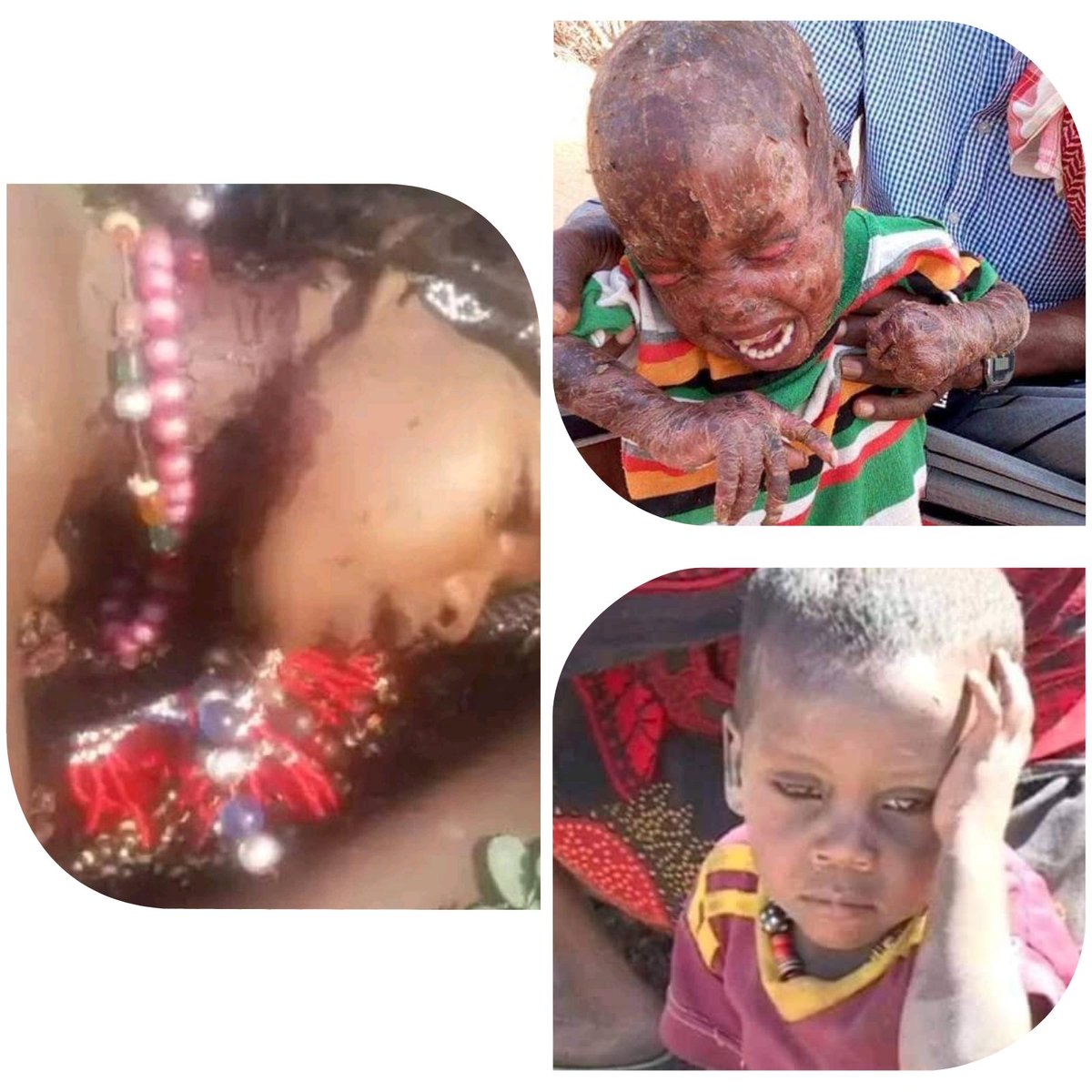 AcmadAdamQafar1's tweet photo. #AfarGenocide #AfarUnderAttack #AfarMassacre https://t.co/PTvphvR3tw