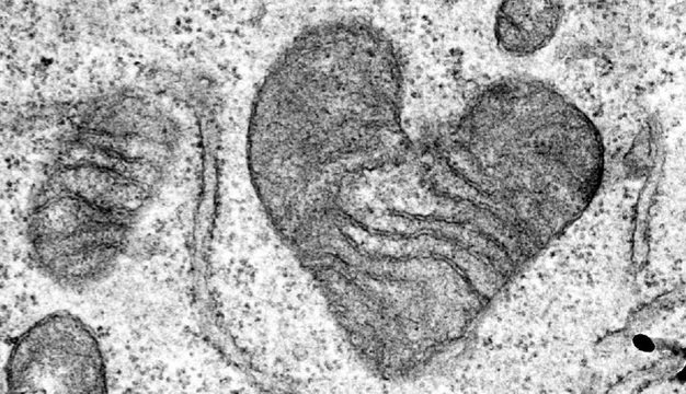 There are mitochondria for every occasion. Found this one from my collection. Happy Valentine Day to mitochondriacs worldwide.
<a href="/MitoSociety/">MitoSociety</a> <a href="/mitojobs/">mitojobs</a>
<a href="/mitowomen/">Women in Mitochondria</a> <a href="/MitochondriaNe1/">Mitochondrial News</a> <a href="/MitoTalksDU/">MitoTalks Down Under</a> <a href="/MitoGenie/">Mitogenie</a> <a href="/mitoscientists/">MitoScientists</a> <a href="/IC_mitochondria/">IC Mitochondriacs</a> <a href="/UMDF/">United Mitochondrial Disease Foundation</a> <a href="/MitoResearch/">Mito Research</a> <a href="/realNathanCheng/">Nathan S. Cheng thinks you should work on aging.</a>