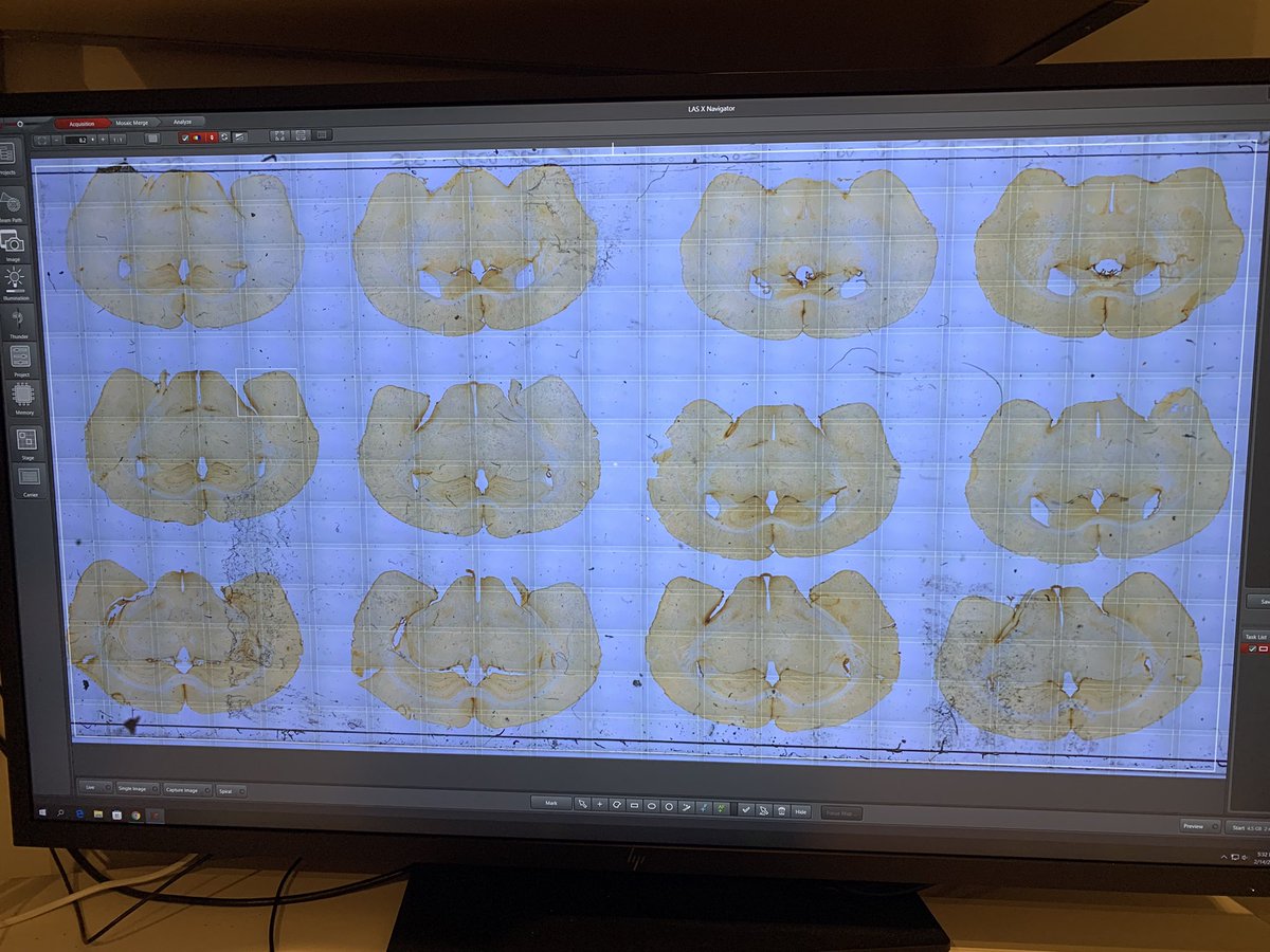 NeuroStemLab's tweet photo. Monday the tweaking day: Alignment of our @LeicaMicro DFC7000T camera on our #Thunderimager and cables adjusted, thanks to Shelly and @ScottMLeica. What a breeze it is to see a whole slide preview with #LASX Navigator then capture at higher mag.! #Liveimagingfacility https://t.co/4ptSqWJhQ9