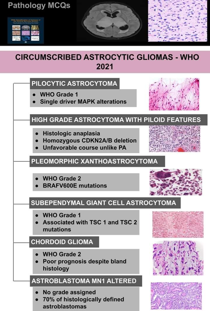 Circumscribed astrocytic gliomas- WHO 2021
#pathologymcq #pathology #PathTwitter #CNS #glioma