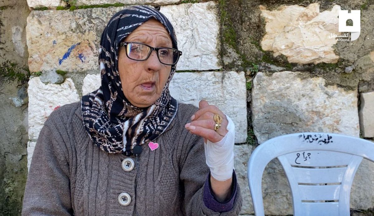 After being attacked by Zionist settlers, Fatima Salem has been admitted to hospital...

Only cowards target the elderly & the weak... 

Little do they know, the scorn of a Palestinian Grandmother & the inescapable result of her prayers.

#SaveSheikhJarrah #انقذوا_حي_الشيخ_الجراح
