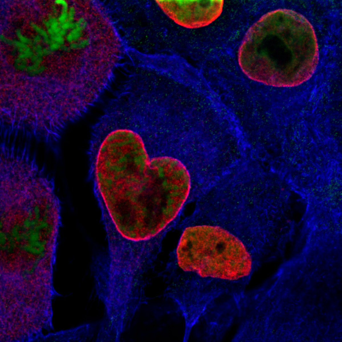 MachPierzynska's tweet photo. Love is in the... cell ! ❤️🔬👩‍🔬
(Lamin A + actin + DNA)
#ValentinesDay

@IITalk
@DiasproLab https://t.co/ZXabnPXM6s