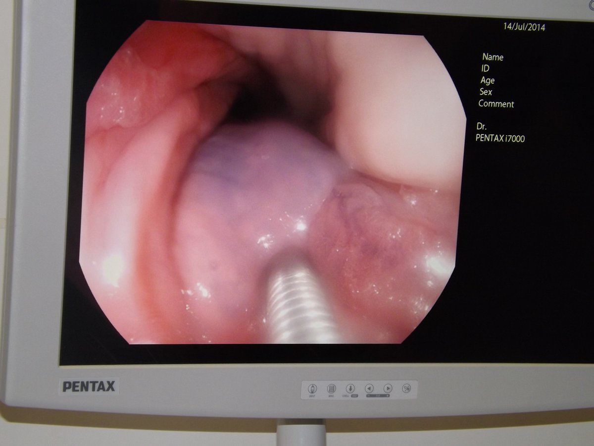 EYSETRAINING's tweet image. Wanting to improve your #polypectomy skills? Spaces available on our next JAG course jets.nhs.uk/yorkshire
Safe #simulation in a relaxed atmosphere - theory and hands on training on porcine models
@BSGTrainees @BritSocGastro @JAG_Endoscopy 
@NHSHEE_NEY @Bjorn_Rembacken