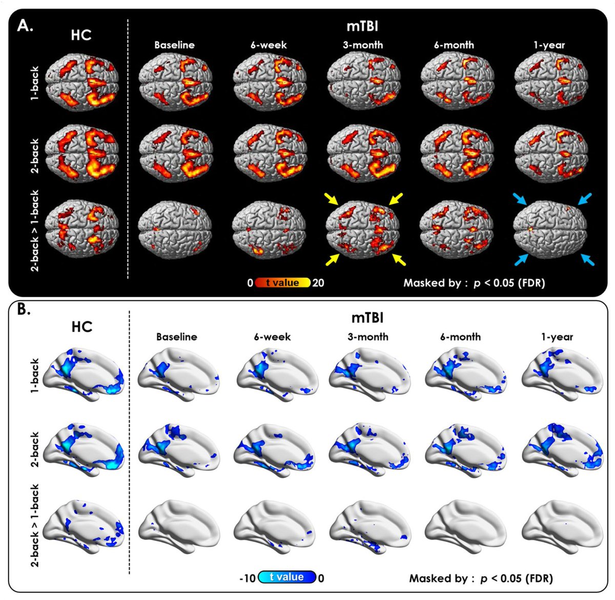 human brain mapping impact factor 2015