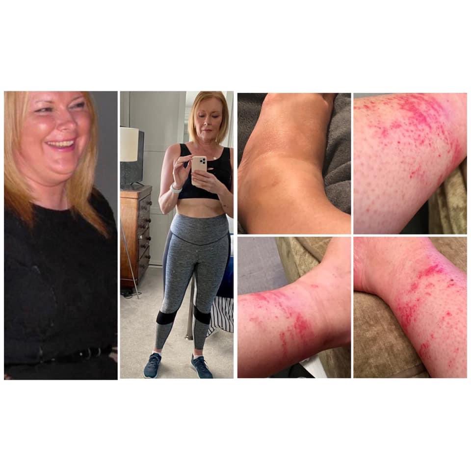 mariatkemp's tweet photo. @GBNEWS @KenDBerryMD Excellent book by Dr Berry, highly recommend it. I’ve solved over 30yrs of autoimmune issues &amp; obesity by ditching the NHS advice &amp; going against the grain (quite literally!) 3 years on, feeling better at almost 51 than I’ve done my entire life &amp; recent blood work is perfect 👍🏻 https://t.co/FPdUkt87Y3