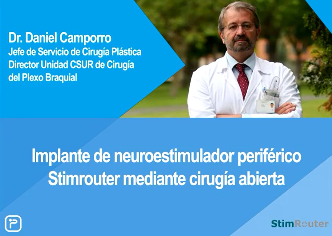 primneuromod's tweet photo. El doctor Daniel Camporro, jefe del Servicio de Cirugía Plástica del @HUCA_Asturias, nos explica cómo se realiza el implante del neuroestimulador #StimRouter™ a través de cirugía abierta.
#neuromdulación #dolorperiférico #dolorcrónico
👉https://t.co/nVFuu2r2Zg https://t.co/g8LdBrrCxK