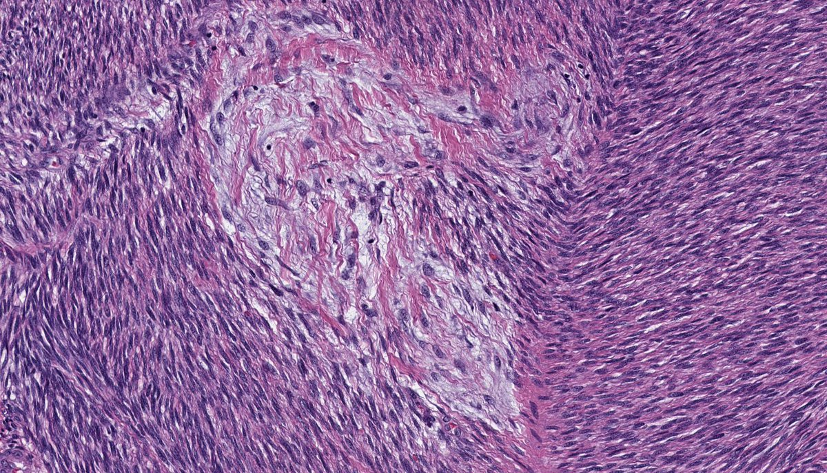 <a href="/DrCarolCheung/">Carol Cheung, MD, PhD, JD</a> <a href="/SammyBytes/">Sammy Lawrence</a> <a href="/abstractica/">Dr. Elle, HCM 👑👻 not much here, but sometimes</a> @kathymahar <a href="/BrainCoach333/">Dove Wilson</a> <a href="/DrDimitrios/">Dimitrios Tsatiris MD</a> <a href="/NakhleDr/">Djenane Nakhle, PhD</a> <a href="/s_prendeville/">Susan Prendeville</a> <a href="/kidneypathology/">Carmen Avila</a> <a href="/GGKovacsBrain/">Gabor G. Kovacs MD PhD FRCPC</a> <a href="/afgao/">Andrew Gao</a> <a href="/pdiamandisii/">Phedias Diamandis</a> @TLStockley