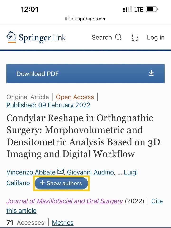 Journal Of Maxillofacial & Oral Surgery (@jmos_official) on Twitter photo JMOS research update-5: Dear readers, please find the download link doi.org/10.1007/s12663… for the article “ condylar reshape in Orthognathic surgery” published in <a href="/JMOS_Official/">Journal Of Maxillofacial & Oral Surgery</a> an official journal of <a href="/aomsiOfficial/">AOMSI (Asso. Oral & Maxillofacial Surgeons India)</a> <a href="/MaxfactsAOMSI/">maxfacts.aomsi</a> Happy reading, Editor JMOS JMOS research update-5: Dear readers, please find the download link doi.org/10.1007/s12663… for the article “ condylar reshape in Orthognathic surgery” published in <a href="/JMOS_Official/">Journal Of Maxillofacial & Oral Surgery</a> an official journal of <a href="/aomsiOfficial/">AOMSI (Asso. Oral & Maxillofacial Surgeons India)</a> <a href="/MaxfactsAOMSI/">maxfacts.aomsi</a> Happy reading, Editor JMOS